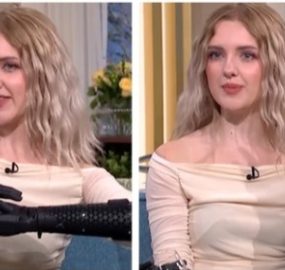 Sci-Fi Becomes Reality: 19-Year-Old Wears World’s Most Advanced Bionic Arms That Move on Their Own
